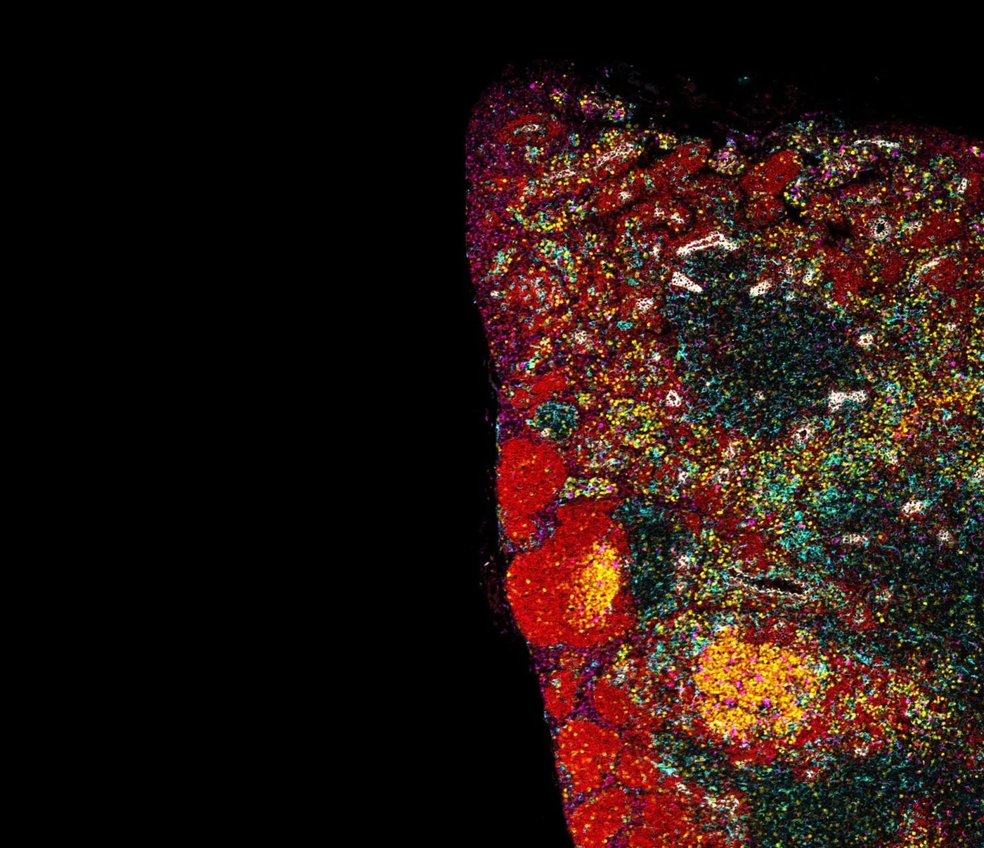 Multiplex immunofluorescence showing germinal centres within a tumour section
